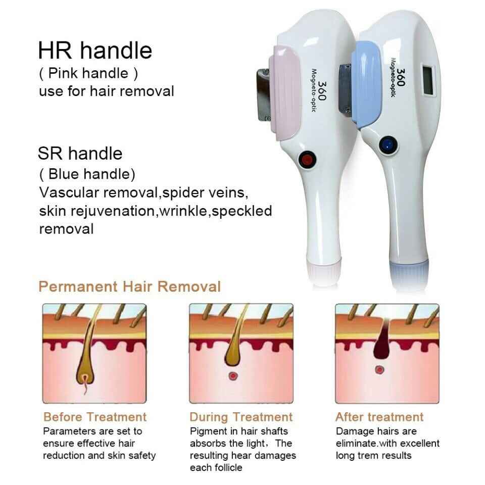 tac dung cua viec triet long tre hoa da cong nghe opt